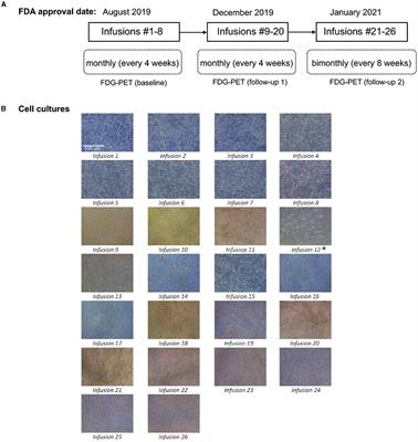 Long-term, repeated doses of intravenous autologous mesenchymal stem cells for a patient with Parkinson's disease: a case report